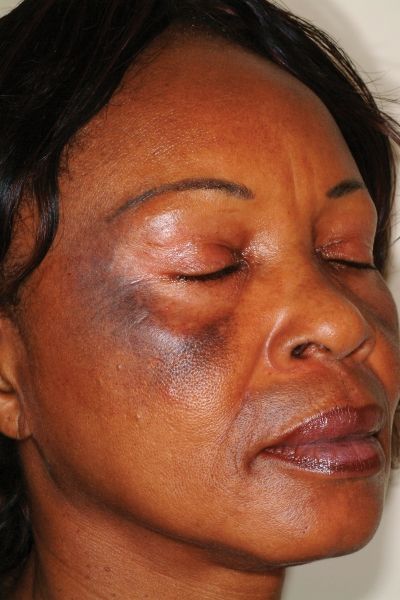 Trust, Representation, and Expertise