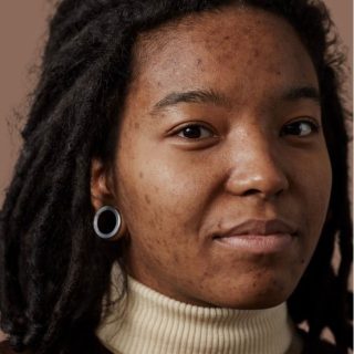 Skin Health in African Communities: Bridging Culture & Modern Care