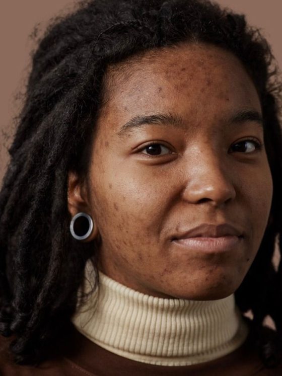 Skin Health in African Communities: Bridging Culture & Modern Care