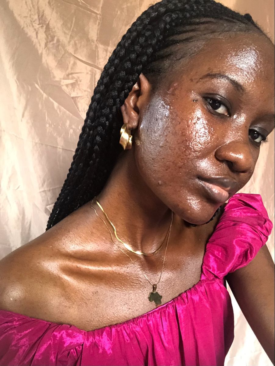 The Hidden Weight of Skin Conditions