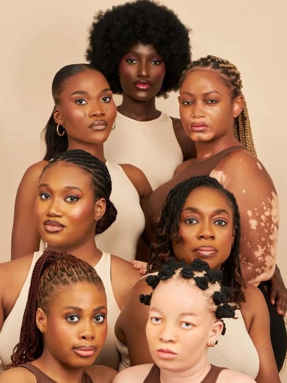 The Market Logic Behind Representation