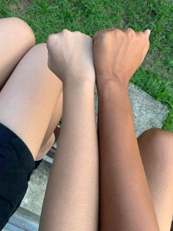 Whitening Creams and the Skin-Bleaching Crisis Destroying African Women's Skin From Within