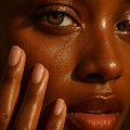 Eczema, Heat Rash, and Fungal Acne: The Skin Conditions African Climates Trigger Most