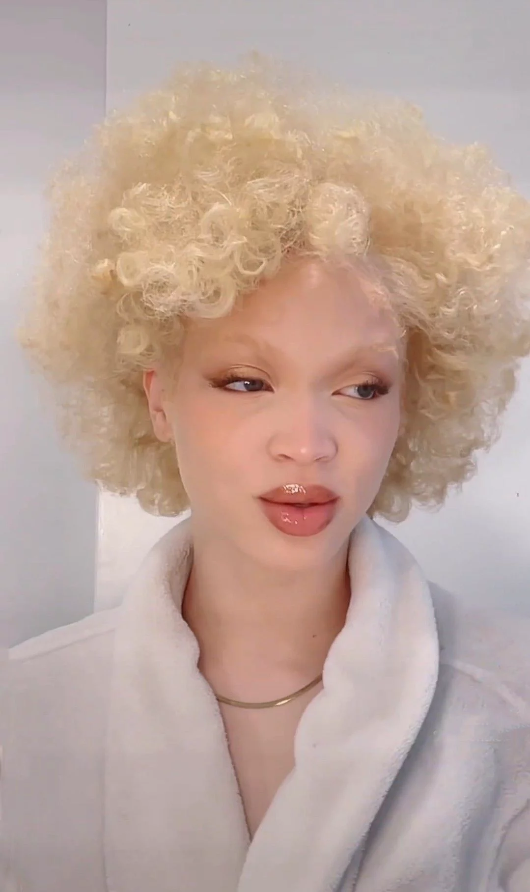 Albinism and Visibility